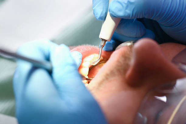 Best Cracked Tooth Emergency Dentist  in Gower, MO