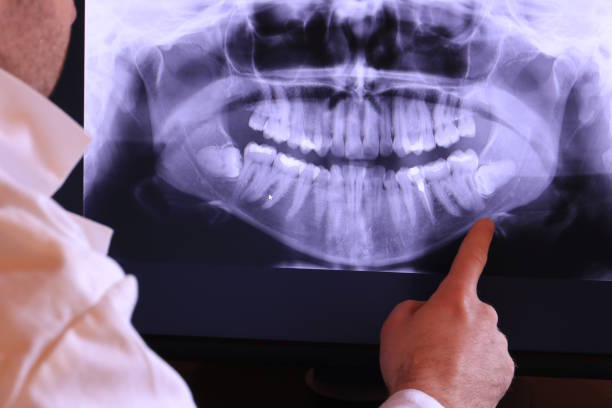 Best Emergency Tooth Extraction  in Gower, MO